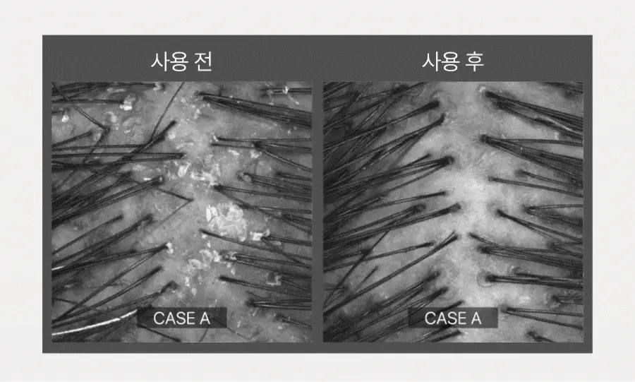 [탄산버블/두피쿨링] 하아르 닥터두피톡스 100ml 상세페이지 21
